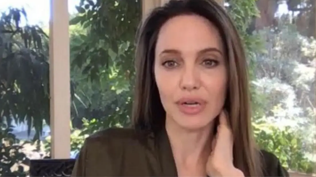 Actress Angelina Jolie has fans concerned over her unrecognizable